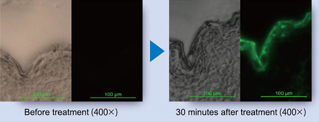 Only 30 minutes after applying the Ceramela solution to the skin, it penetrates the stratum corneum.