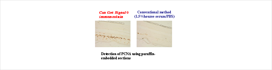 Can Get Signal™immunostain Immunoreaction Enhancer Solution Can Get Signal™immunostain Immunoreaction Enhancer Solution